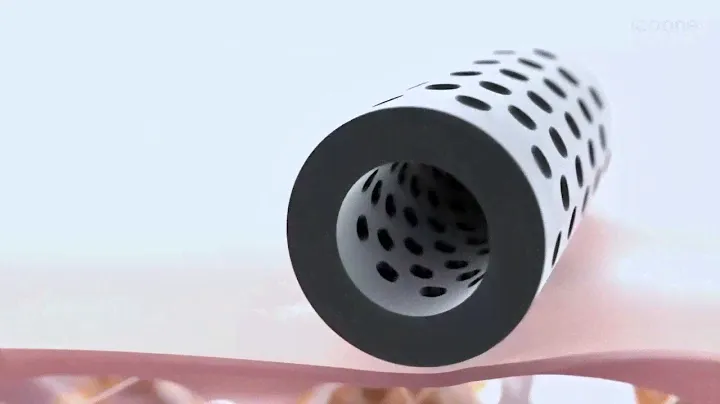 Icoone laser