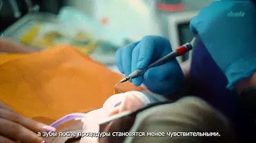 TouchWhite - запатентованное отбеливание зубов последнего поколения с помощью лазера Fotona  Er-Yag!